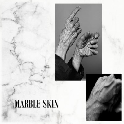 marble-skin
